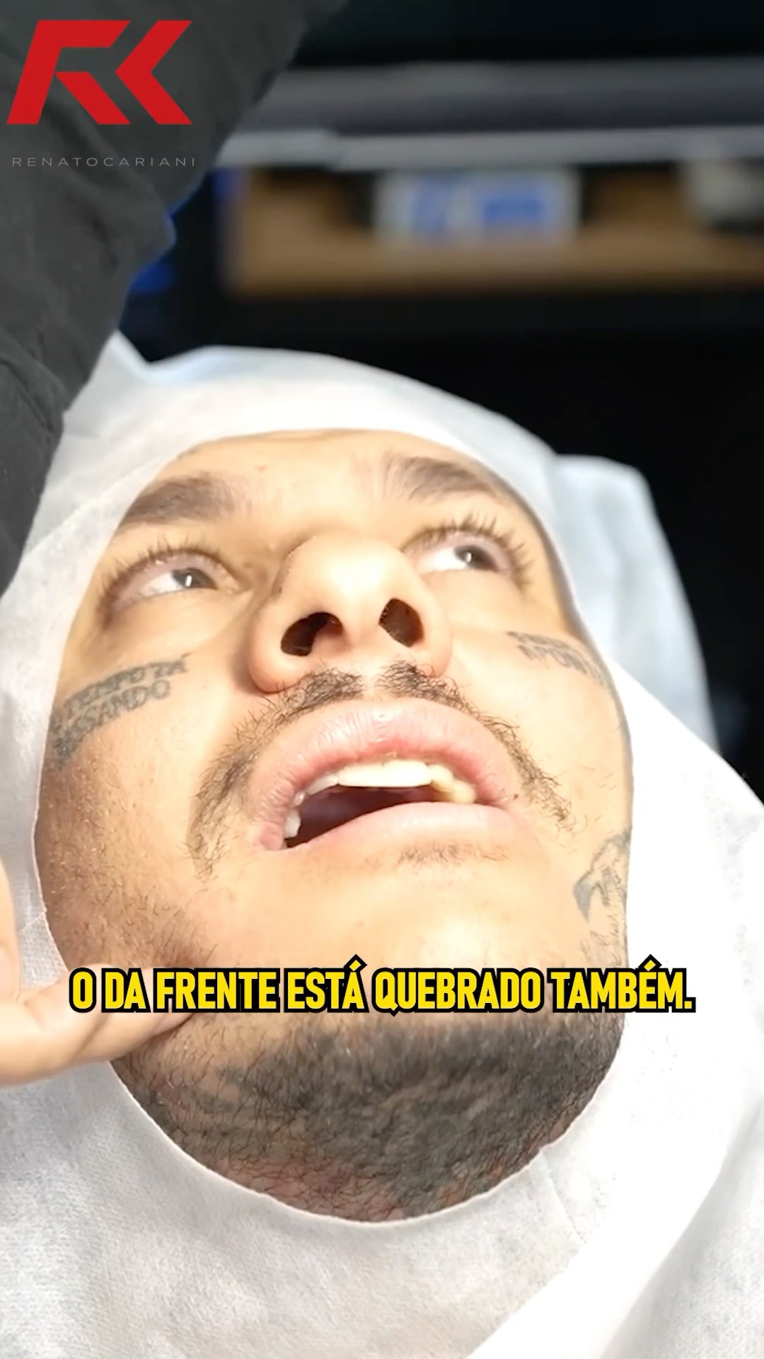 A SITUAÇÃO DOS DENTES DO TOGURO NÃO ESTÁ BOA! #renatocariani #juliobalestrin #toguro #maumauzk #meme