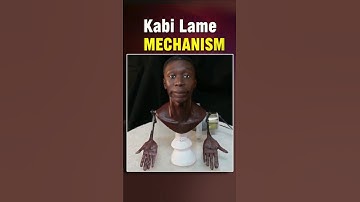 Kabi Lame Mechanism Meme Got Out of Control 💀