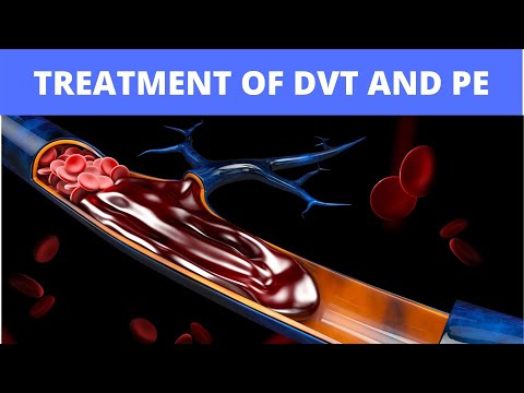Treatment of DVT and PE