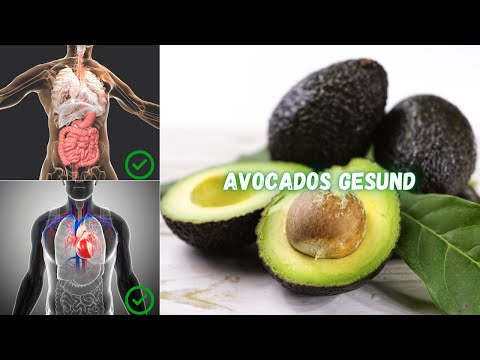 7 Gründe, warum Avocados gesund sind