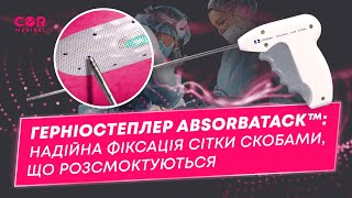 AbsorbaTack™: герніостеплер для безпечної та ефективної фіксації сітки під час герніопластики
