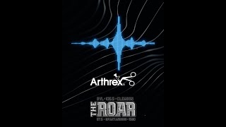 Arthrex Achilles Midsubstance SpeedBridge, Dr. Steve Martin on Clemson Sports Radio Station The ROAR