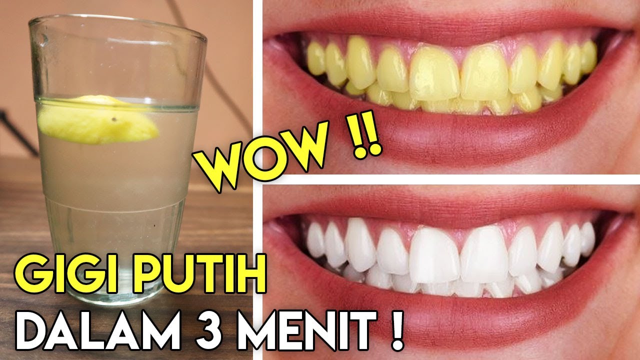 Cara Memutihkan Gigi Dengan Cepat