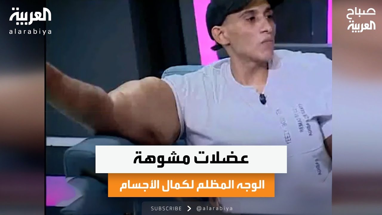 عضلات مشوهة.. الوجه المظلم لكمال الأجسام