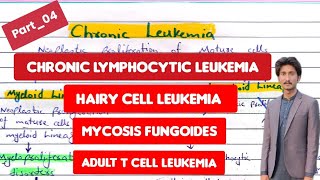 Chronic lymphocytic leukemia (4)|Hairy cell leukemia|adult T cell leukemia|Mycosis fungoides