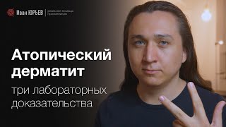 Атопический дерматит у призывников: чем помогут анализы на IgE, ЭКБ и Phadiatop