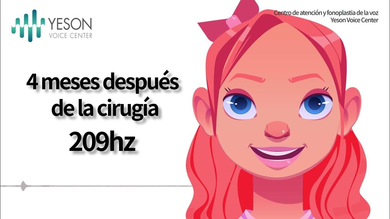 Paciente de Yeson de EE. UU.Revisión postoperatoria de 4 meses de cirugía VFSRAC YouTube Paciente de Yeson de EE. UU.Revisión postoperatoria de 4 meses de cirugía VFSRAC YouTube