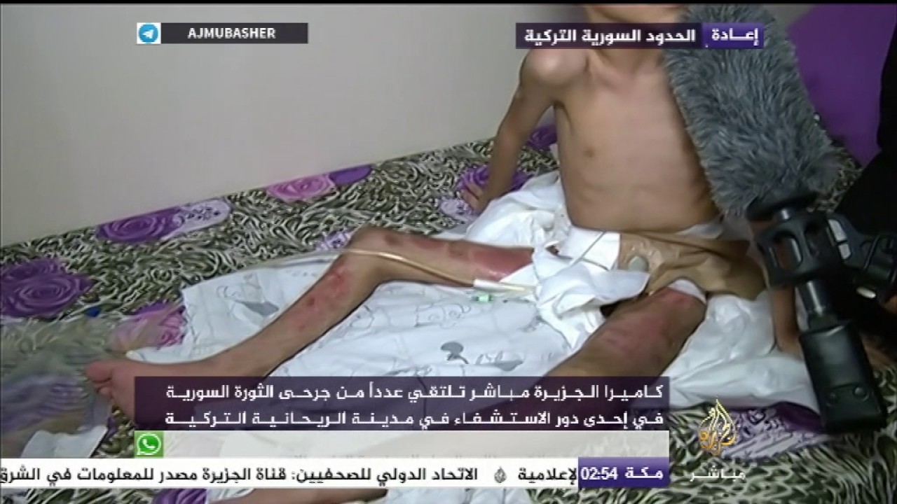لقاء مع عدد من جرحى الثورة السورية في إحدى دور الاستشفاء في مدينة الريحانية التركية