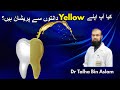 Yellow teeth to white teeth teeth whitening procedure by dr talha bin aslam