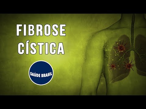 Vídeo: Coisas A Saber Sobre O Início Do Tratamento Para Fibrose Cística