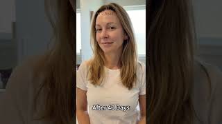 #SnailMucinSkincare #HydratingEssenceReview #DrySkinSolutions #SensitiveSkinFriendly