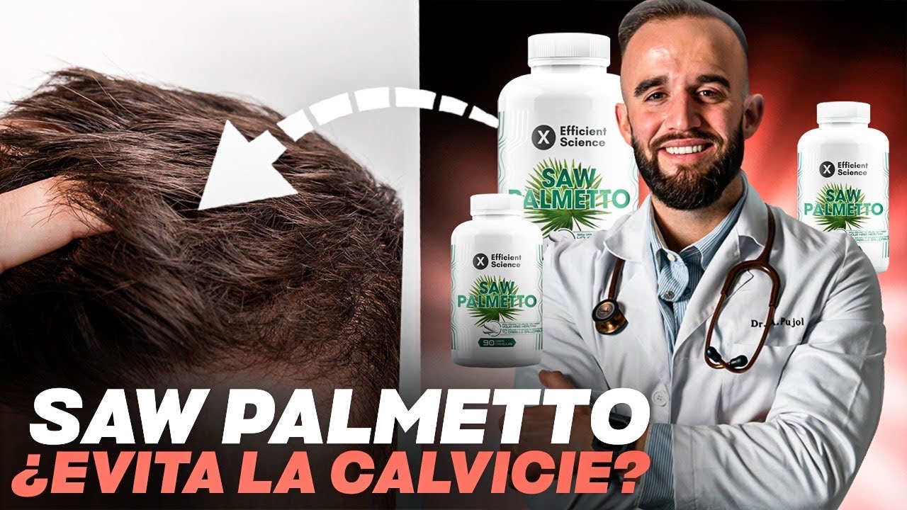 SAW PALMETTO: ¿EVITA LA CALVICIE?