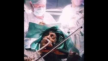 Video bệnh nhân chơi vĩ cầm trong lúc bác sĩ phẫu thuật cắt u não