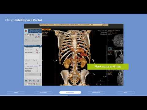 Philips IntelliSpace Portal clinical application CT TAVI planning