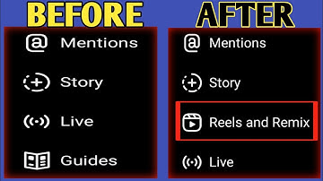 Instagram Reels And Remix Options Not Showing 2022// Fix Reels Remix Not Showing