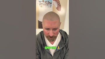 Botched SMP fix #scalpmicropigmentation