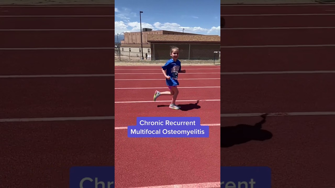 Update on CRMO (Chronic Recurrent Multifocal Osteomyelitis