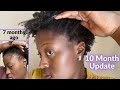 I Grew My Edges Back Without Growth Oils and Butters! |30 Day Hair Detox| 10 Month Update