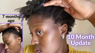 I Grew My Edges Back Without Growth Oils and Butters! |30 Day Hair Detox| 10 Month Update