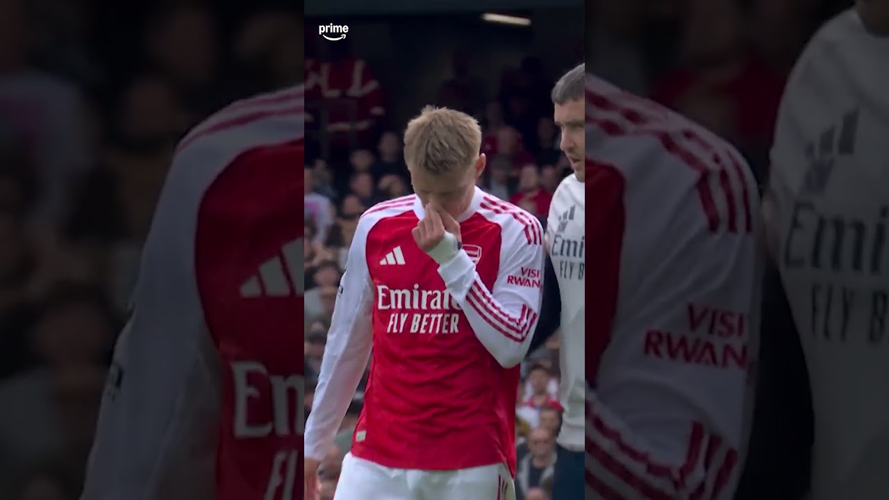 🤕 Een nare val voor Martin Ødegaard betekent einde wedstrijd voor hem 🙅🏼♂️ #PremierLeague #Arsenal