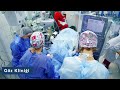 Göz Hastalıkları Kliniği - Katarakt