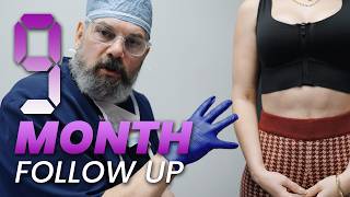 9 Months After a Breast Lift: Real Results &amp; Scar Healing
