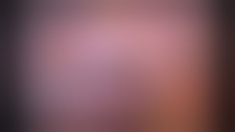 laparoscopic appendectomy, mesoappendix division with cautery