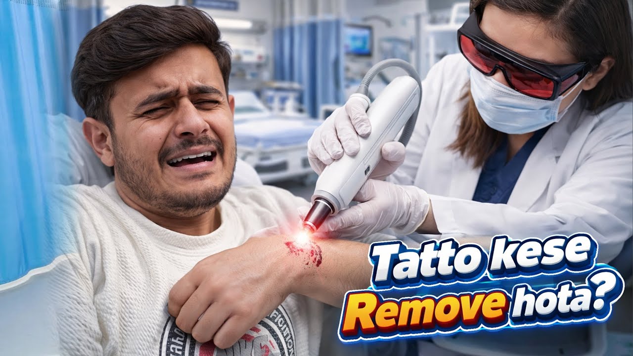 Laser Tattoo Removal Full Process 😰 | Painful or Safe?