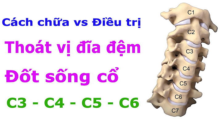 Phình đĩa đệm đốt sống cổ tiếng anh là gì năm 2024