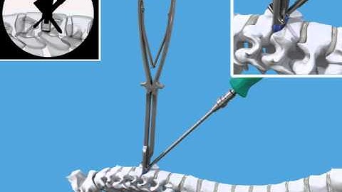 Animation Zero P no logo