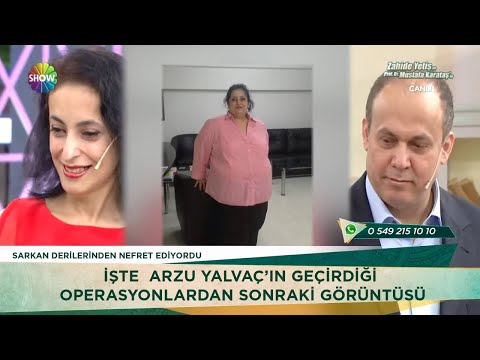 94 kilo veren Arzu Hanım'ın şaşırtan değişimi!