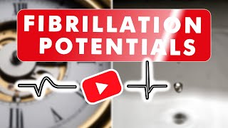 Fibrillation Potentials