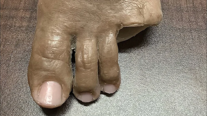 Silicone Foot Prosthesis - Cosmetic Restoration