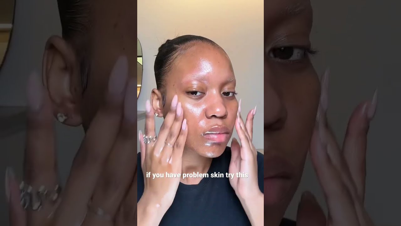 daily skincare routine for acne skin 