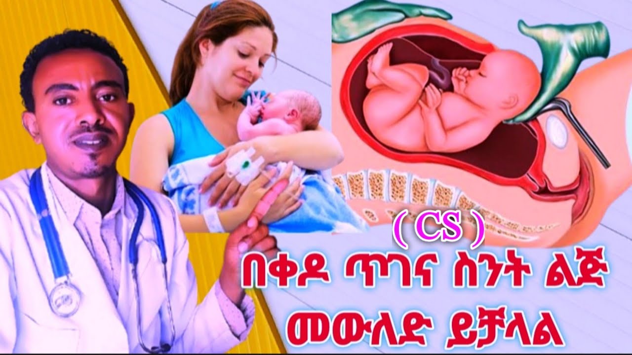 በቀዶ ጥገና እስከ ስንት ልጅ መውለድ ይቻላል/ How many children can be born by surgery#health #doctor #love