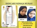 Skincare routine pagi malam 085755662022 daily skincare skincare mencerahkan