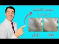 اقوى وصفة طبيعية هتبيض بشرتك ٣ درجات