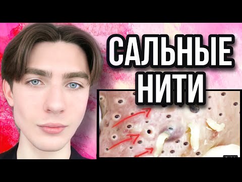 Сальные нити и черные точки | Расширенные поры | Как убрать?