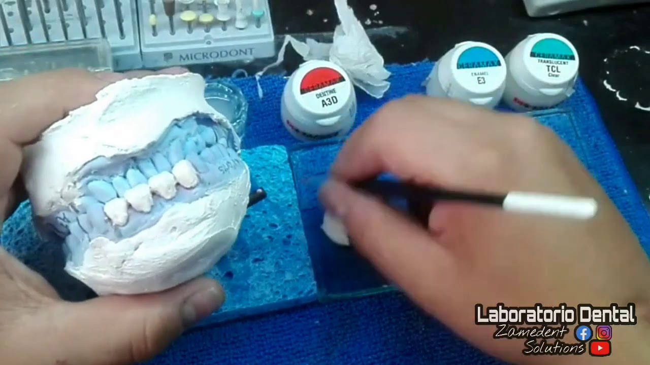 METAL PORCELANA - PROCESO DE MONTADO / CERAMAX