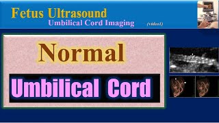 Fetus Ultrasound, Normal Umbilical cord
