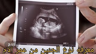 اعرفي نوع جنينك من عمرك مضمونه اوووي من اول معرفه حملك بأمر الله