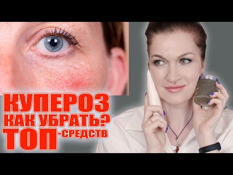 Полная система ухода против купероза! От очищения до ночной рутины. 100 результат! 💥💥💥