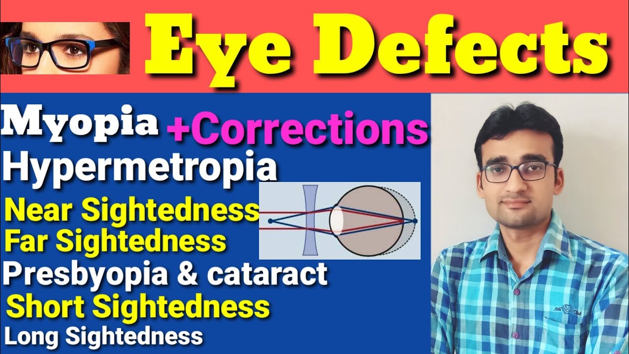 Eye Defects Hypermetropia Myopia Near Sightedness And Far Sightedness Presbyopia Cataract Youtube Eye Defects Hypermetropia Myopia Near Sightedness And Far Sightedness Presbyopia Cataract Youtube