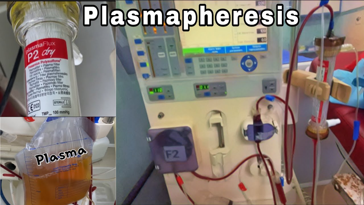 what-is-plasmapheresis-plasma-exchange-plasmapheresis-dialysis