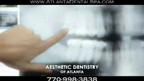 Atlanta Cosmetic Dentist-Drs. Peter Boulden and Susan Estep