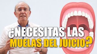 ¿Es necesaria la extracción de las muelas del juicio?