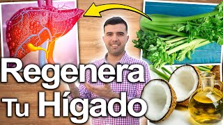 BARRE LA GRASA DE TU HIGADO EN 1 SEMANA CON ESTO!-Cómo Limpiar Y Desintoxicar El Hígado Naturalmente