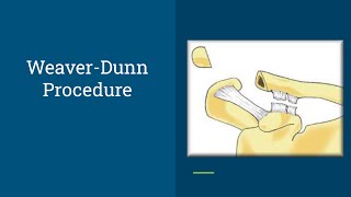 Key Step In The Weaver-Dunn Procedure Frcs Tr & Orth & Ebot Part A Prep