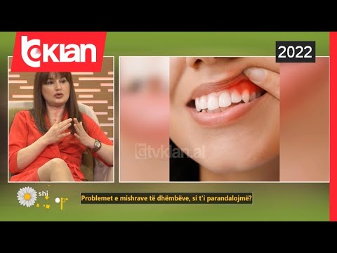 Video: Si të ndaloni kruajtjen e mishrave të dhëmbëve (me fotografi)