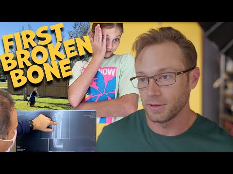 Our First Broken Bone and it was Caught on Camera!  Doctors visits, X Rays and much more!